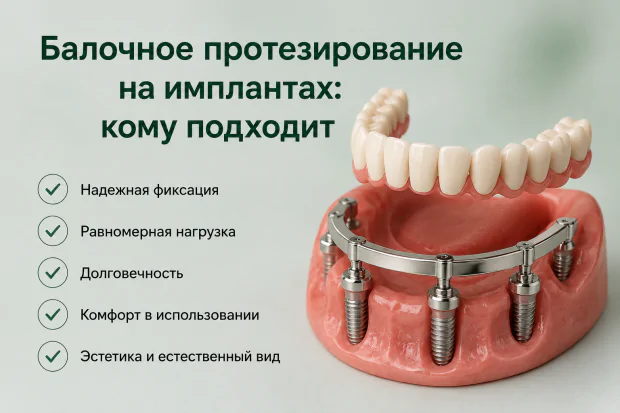 Картинка статьи